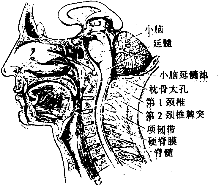 图9 哑门穴的解剖